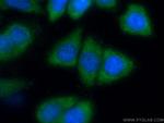 IKBKG Antibody in Immunocytochemistry (ICC/IF)