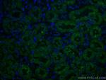 Caspase 3/p17/p19 Antibody in Immunohistochemistry (Paraffin) (IHC (P))