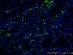 PSAP Antibody in Immunohistochemistry (Paraffin) (IHC (P))