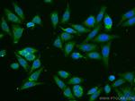 ATF6 Antibody in Immunocytochemistry (ICC/IF)