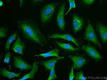 CHST4 Antibody in Immunocytochemistry (ICC/IF)