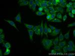 GSTP1 Antibody in Immunocytochemistry (ICC/IF)