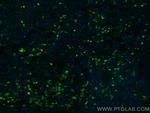 TSH Beta Antibody in Immunohistochemistry (Paraffin) (IHC (P))