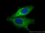 HSP27 Antibody in Immunocytochemistry (ICC/IF)