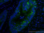 AGR2 Antibody in Immunohistochemistry (Paraffin) (IHC (P))