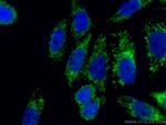 TOM20 Antibody in Immunocytochemistry (ICC/IF)