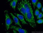 LACTB Antibody in Immunocytochemistry (ICC/IF)