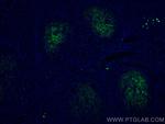 CD82 Antibody in Immunohistochemistry (Paraffin) (IHC (P))