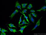 GRB2 Antibody in Immunocytochemistry (ICC/IF)