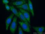 NFATC2 Antibody in Immunocytochemistry (ICC/IF)