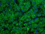 ADK Antibody in Immunohistochemistry (Paraffin) (IHC (P))