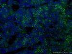 ICAM4 Antibody in Immunohistochemistry (Paraffin) (IHC (P))