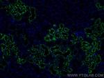 LGMN Antibody in Immunohistochemistry (Paraffin) (IHC (P))