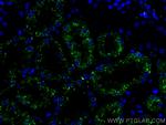 LGMN Antibody in Immunohistochemistry (Paraffin) (IHC (P))