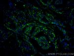 GUK1 Antibody in Immunohistochemistry (Paraffin) (IHC (P))