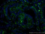 GUK1 Antibody in Immunohistochemistry (Paraffin) (IHC (P))