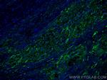 Endoglin/CD105 Antibody in Immunohistochemistry (Paraffin) (IHC (P))