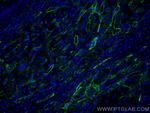 Endoglin/CD105 Antibody in Immunohistochemistry (Paraffin) (IHC (P))