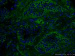 RALB Antibody in Immunohistochemistry (Paraffin) (IHC (P))