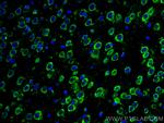 L1CAM Antibody in Immunohistochemistry (Paraffin) (IHC (P))