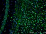 L1CAM Antibody in Immunohistochemistry (Paraffin) (IHC (P))