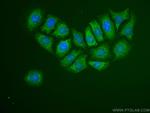 TRIM21 Antibody in Immunocytochemistry (ICC/IF)