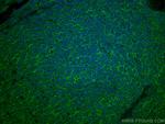 SLC31A1 Antibody in Immunohistochemistry (Paraffin) (IHC (P))