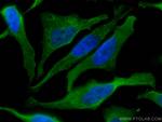 TRIM25 Antibody in Immunocytochemistry (ICC/IF)