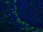 TLR8 Antibody in Immunohistochemistry (Paraffin) (IHC (P))