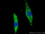 PSMD9 Antibody in Immunocytochemistry (ICC/IF)