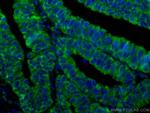 TSG101 Antibody in Immunohistochemistry (Paraffin) (IHC (P))