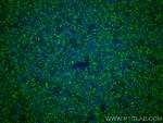 LACTB2 Antibody in Immunohistochemistry (Paraffin) (IHC (P))