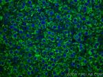 LACTB2 Antibody in Immunohistochemistry (Paraffin) (IHC (P))