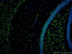 ACVR1 Antibody in Immunohistochemistry (Paraffin) (IHC (P))