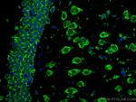 ACVR1 Antibody in Immunohistochemistry (Paraffin) (IHC (P))