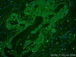 KLK11 Antibody in Immunohistochemistry (Paraffin) (IHC (P))