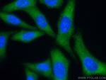 eIF4G2/DAP5 Antibody in Immunocytochemistry (ICC/IF)