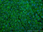 BDH1 Antibody in Immunohistochemistry (Paraffin) (IHC (P))