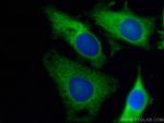 ALDOA Antibody in Immunocytochemistry (ICC/IF)