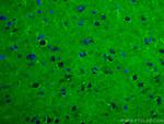 RAB2A Antibody in Immunohistochemistry (Paraffin) (IHC (P))