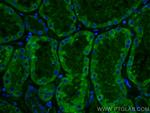 SLC2A9 Antibody in Immunohistochemistry (Paraffin) (IHC (P))