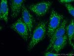 Tim23 Antibody in Immunocytochemistry (ICC/IF)