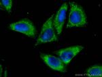 RIG-1/DDX58 Antibody in Immunocytochemistry (ICC/IF)