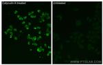 Phospho-GSK3B (Ser9) Antibody in Immunocytochemistry (ICC/IF)