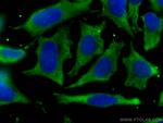 PHGDH Antibody in Immunocytochemistry (ICC/IF)