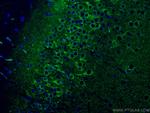 P2RY1 Antibody in Immunohistochemistry (Paraffin) (IHC (P))