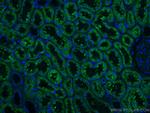 ERP29 Antibody in Immunohistochemistry (Paraffin) (IHC (P))