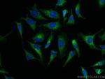 EPRS Antibody in Immunocytochemistry (ICC/IF)