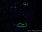 smooth muscle actin Antibody in Immunohistochemistry (Paraffin) (IHC (P))