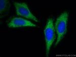 USP14 Antibody in Immunocytochemistry (ICC/IF)